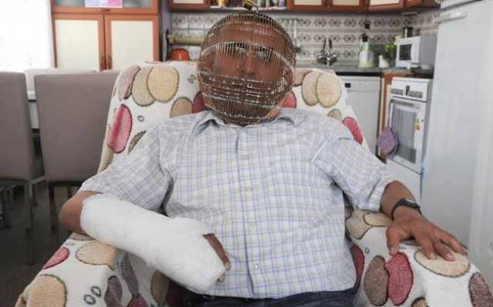 Житель Турции Заковал Голову В Клетке, Чтобы Бросить Курить